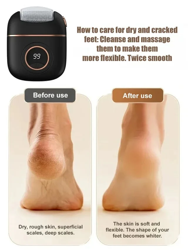 🔥2024 New Arrival💝New Digital Electric Foot Polisher - Image 3